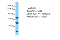 SACS Antibody, Novus Biologicals 100 &mu;L; Unconjugated:Antibodies, Polyclonal